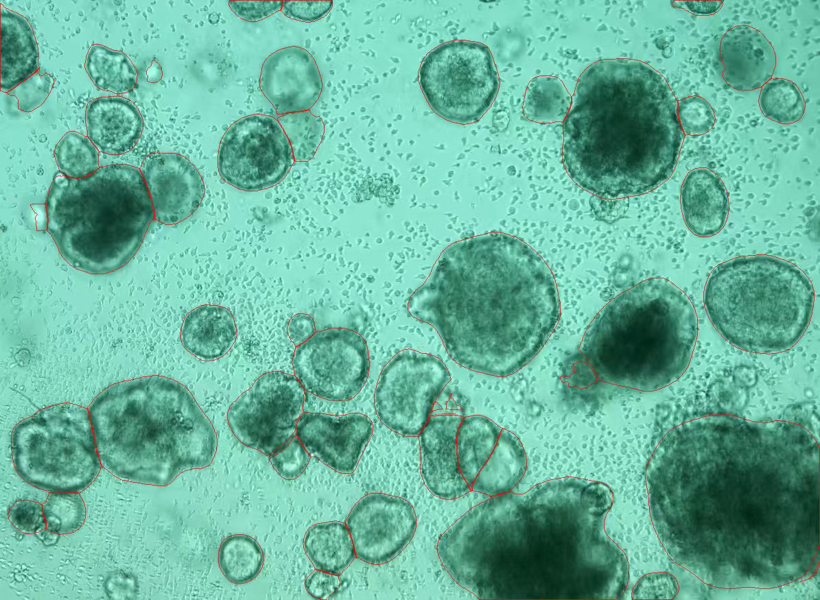 類器官成像分析
